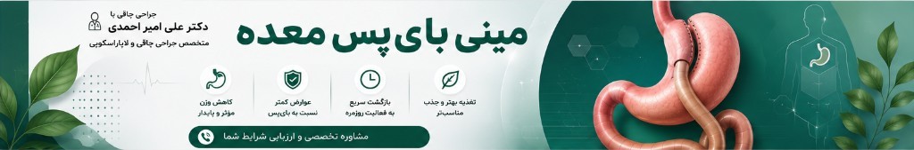 اینفوگرافیک مینی بای‌پس