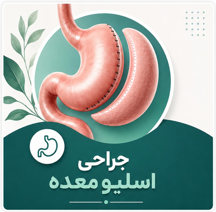 جراحی اسلیو معده