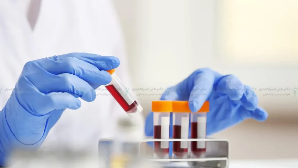 آزمایش خون قبل از عمل لاغری