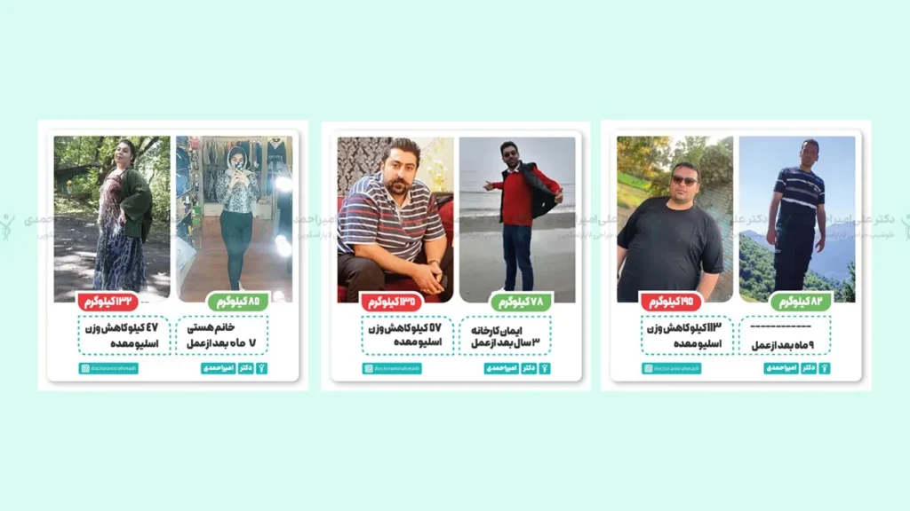 قبل و بعد از عمل لاغری
