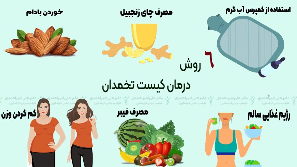روش های درمان کیست تخمدان