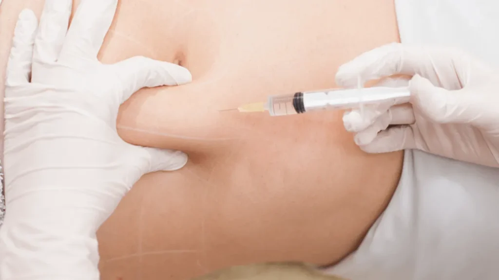 مزوتراپی سریع ترین راه لاغری شکم و پهلو
