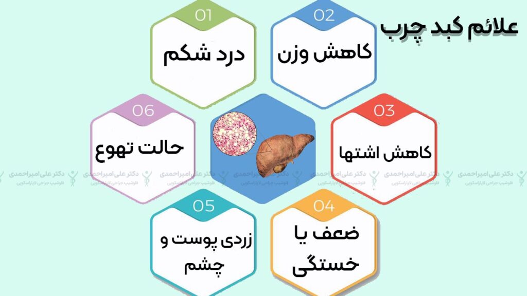 رایج ترین علائم کبد چرب چیست؟