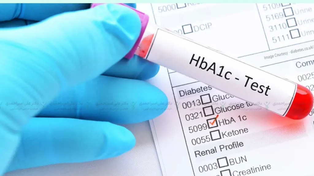 تست HgbA1C از آزمایش های قبل از عمل لاغری