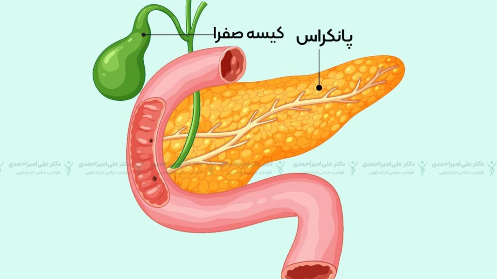 پانکراس