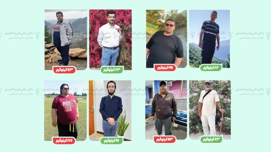 عکس قبل و بعد از عمل لاغری