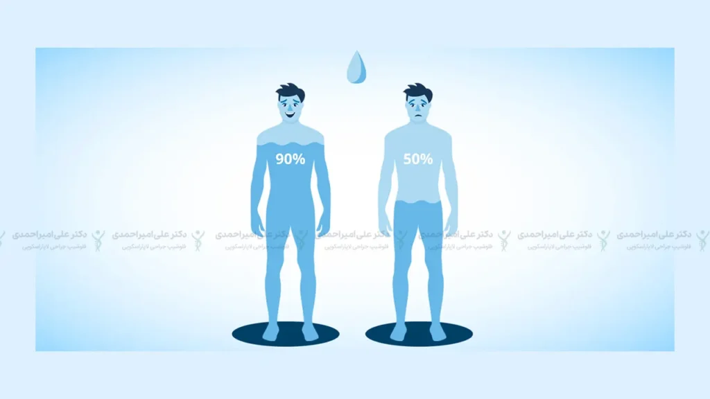 کم آبی بدن به دنبال روزه گرفتن بعد از اسلیو معده