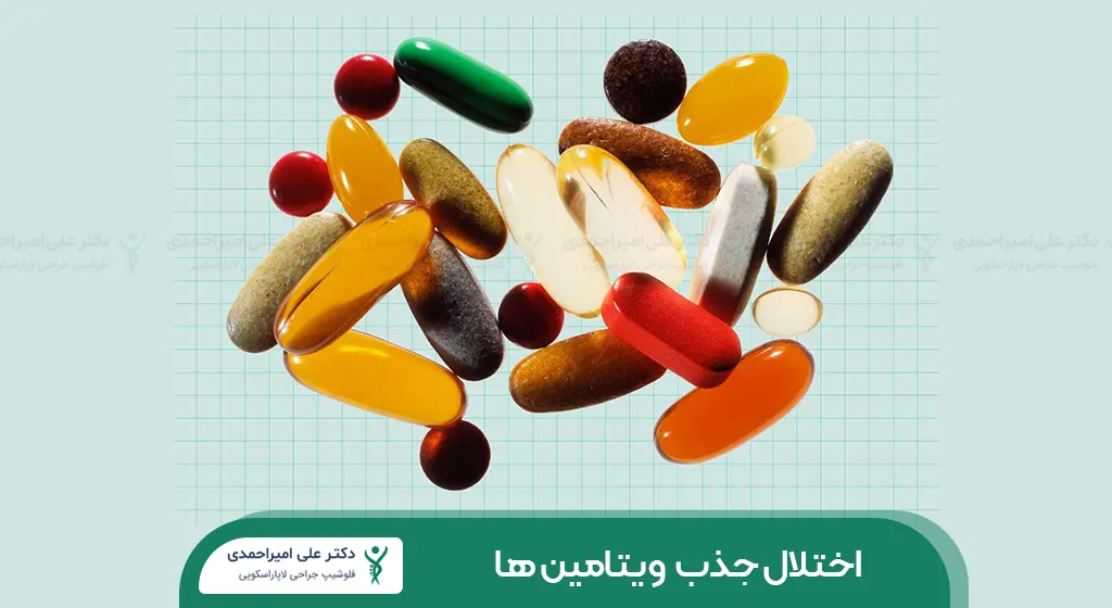 اختلال جذب ویتامین بعد از اسلیو معده