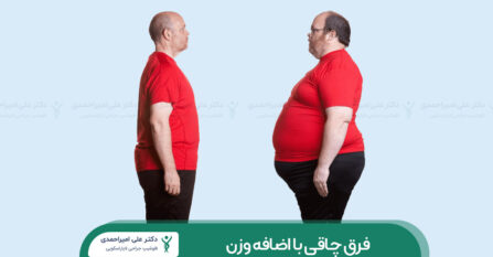 فرق چاقی با اضافه وزن