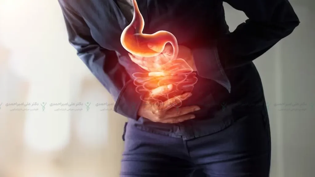 دلایل مصرف قرص پنتوپرازول بعد از اسلیو معده