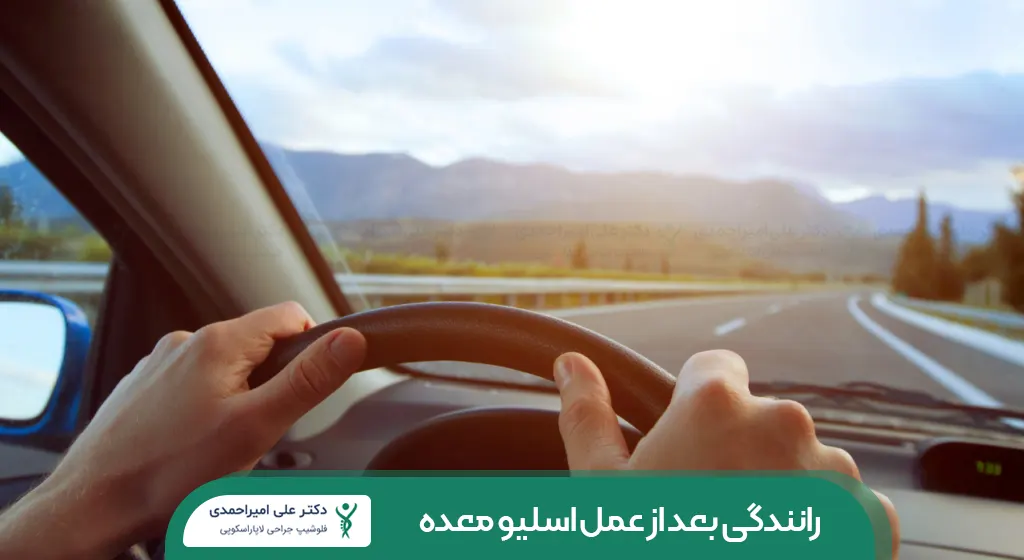 رانندگی بعد از عمل اسلیو معده شاخص
