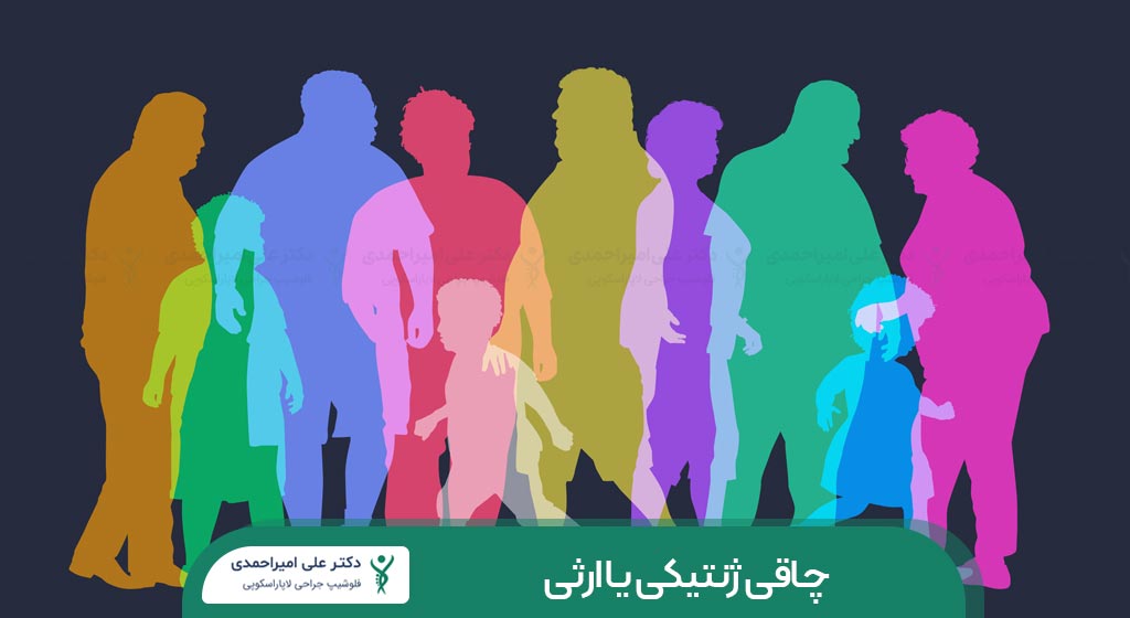 چاقی ارثی