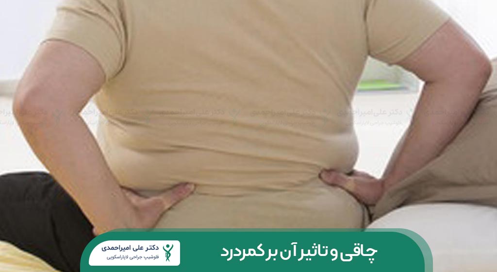 چاقی و تاثیر آن بر کمردرد